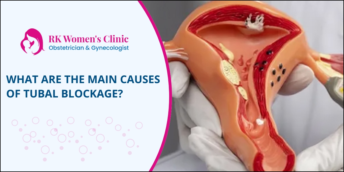 Causes of tubal blockage